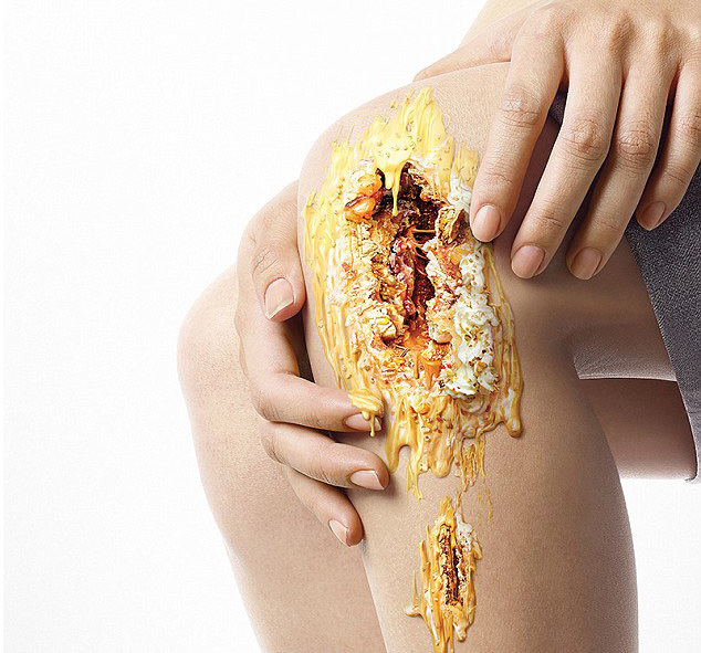 泰国一糖尿病广告现&ldquo;甜蜜伤口&rdquo; 网友:不敢吃甜食了