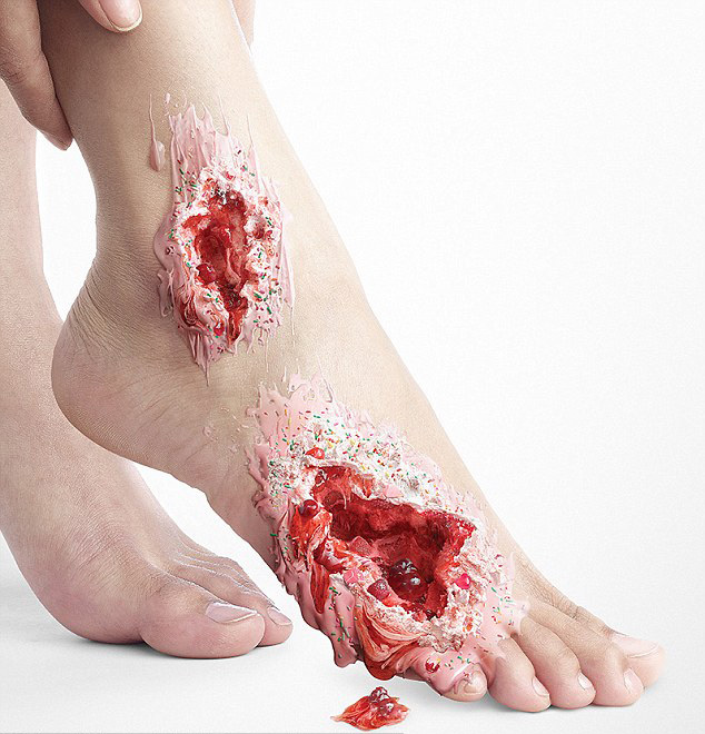 泰国一糖尿病广告现&ldquo;甜蜜伤口&rdquo; 网友:不敢吃甜食了