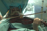 立陶宛女子脑部手术时拉小提琴曲【组图】