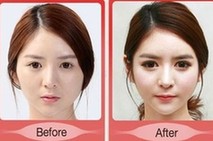 图揭日韩女生整容实录 日本女生整成&ldquo;瓷娃娃&rdquo; （组图）